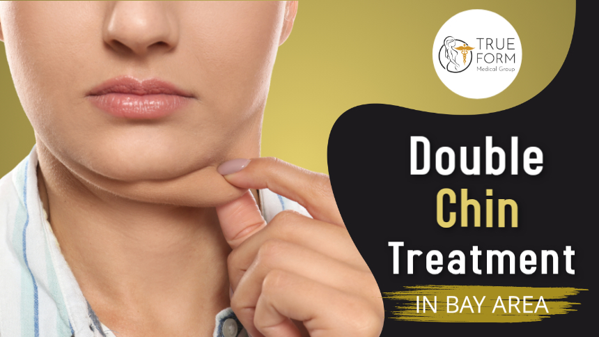 Double Chin Treatment in Oakland