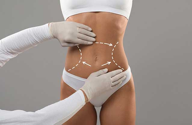Body sculpting treatment in Bay Area