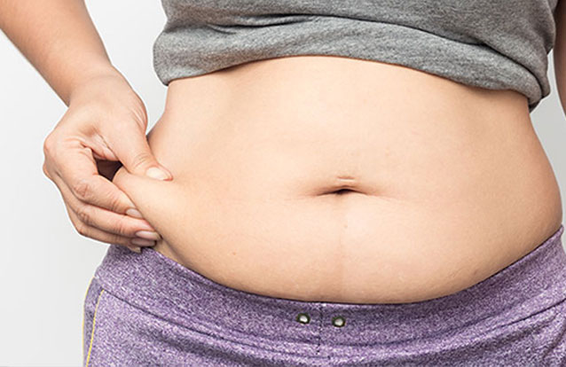 Belly fat in need of radiofrequency fat reduction in Bay Area