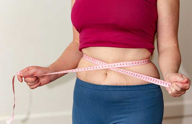 overweight female needing emsculpt in Bay Area