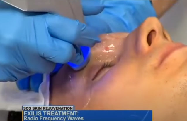 Exilis ultra featured on Good Day PA