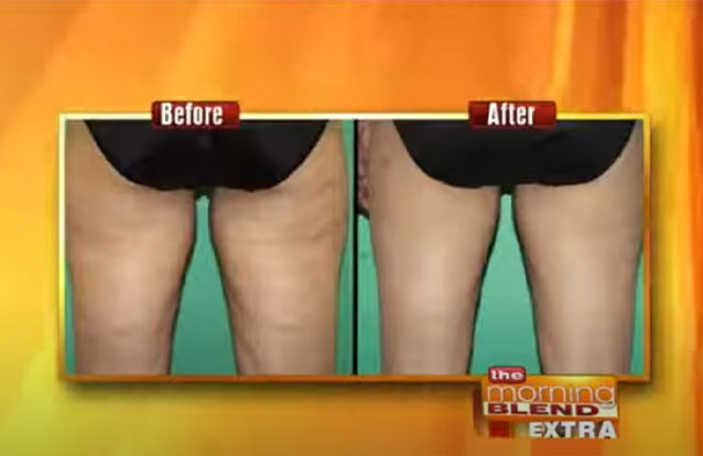 Exilis ultra featured on The Morning Blend