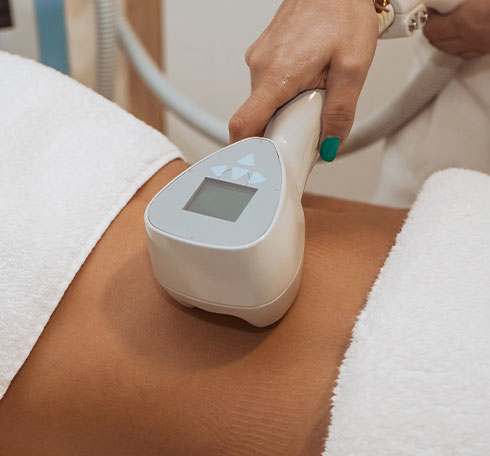 Exilis for body at Bay Area Med Spas in Oakland and Fremont